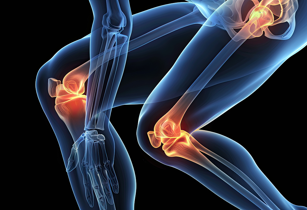 graphic of skeletal muscular leg with pain point